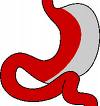 Gastric sleeve